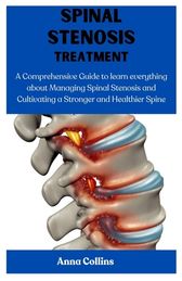 Spinal Stenosis Treatment A Comprehensive Guide To Learn Everything