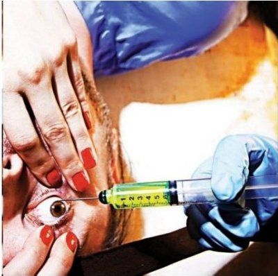 Acid or Blood - (Import CD)