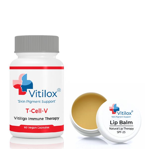 Vitiligo Vitilox Lip Balm &amp; Vitilox T-Cell-V Immune Therapy