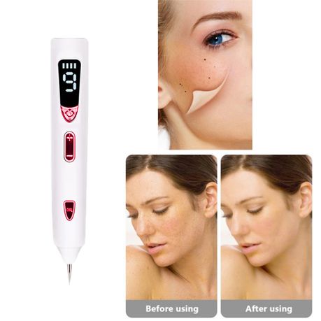 LCD Skin Care Laser Pen Mole Tattoo Freckle Plasma Removal Pen-Champagne |  Buy Online in South Africa 