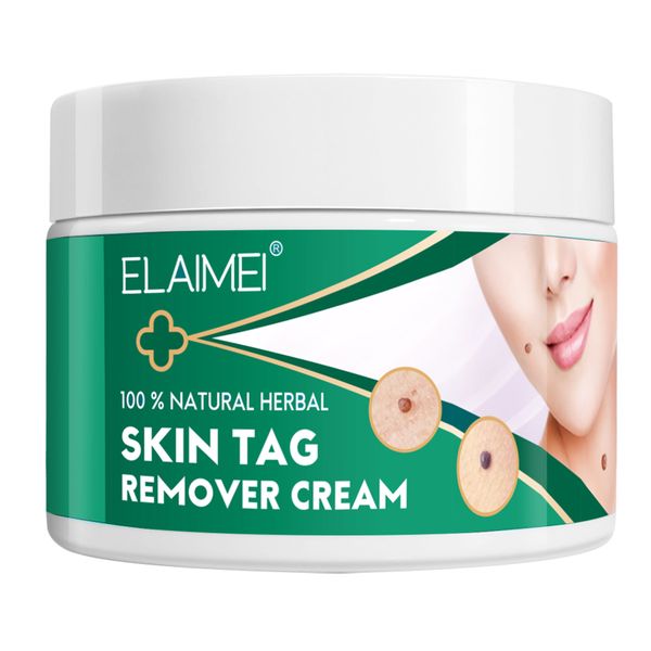 100% Natural Herbal-Skin Tag Remover Cream-Safe-Painless and Reliable