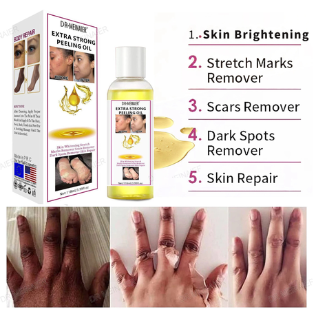 Dr Meinaier Extra Strong Peeling Oil + Lip Balm | Shop Today. Get it  Tomorrow!