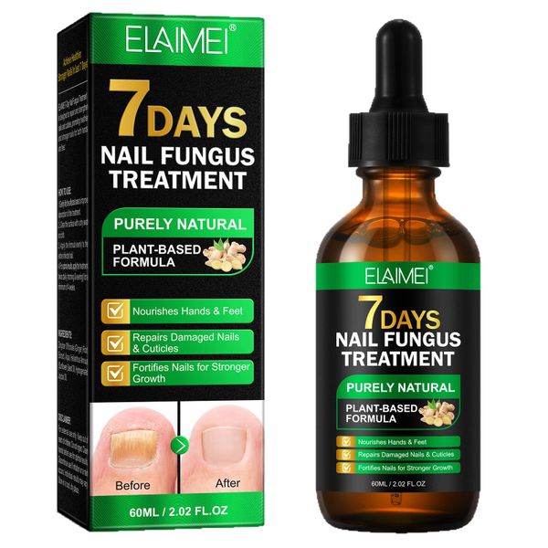 7 Days Nail Fungus Treatment, Natural Plant-Based Formula, 60ml Nail Growth