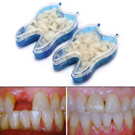 Teeth Repair Kit, Moldable False Teeth, with Dental Tools