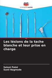 Les L Sions De La Tache Blanche Et Leur Prise En Charge | Shop Today ...