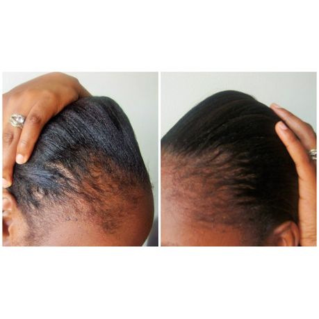 Jamaican Black Castor Oil - Hair Fertilizer - 70g & 2 KN95 Masks | Buy  Online in South Africa | takealot.com