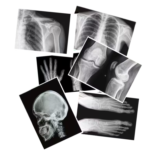 Education School Science Realistic Human X-Ray Bone Anatomy Prop (30cm)-6pc
