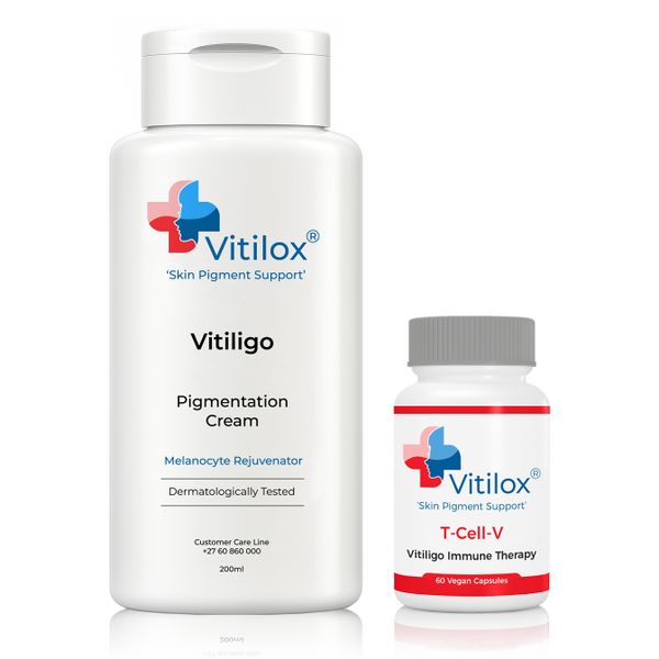 Vitiligo Vitilox Pigmentation Cream &amp; Vitilox T-Cell-V Immune Therapy