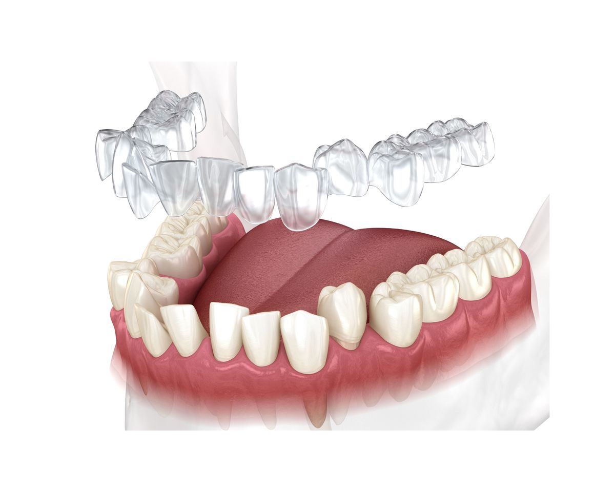 Retainer Canvas Print Buy Online in South Africa