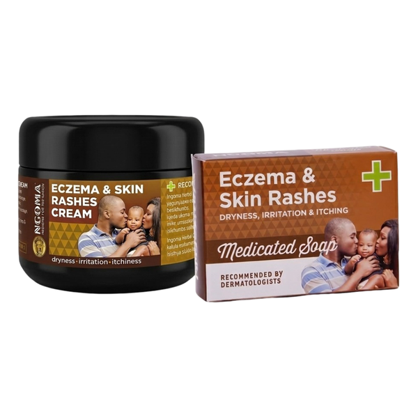 NGOMA - Eczema &amp; Skin Rashes Cream + Eczema Soap Skin Wellness Combo
