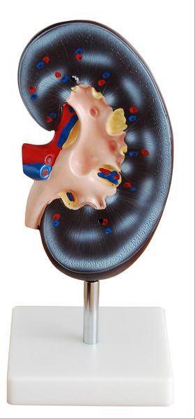 Anatomical Kidney Model (2 parts)