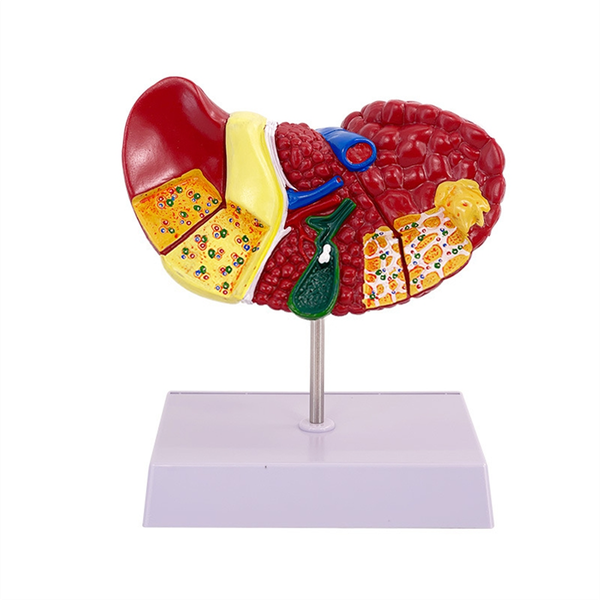 Liver Model For Common Pathologies, Liver Model Human Anatomy