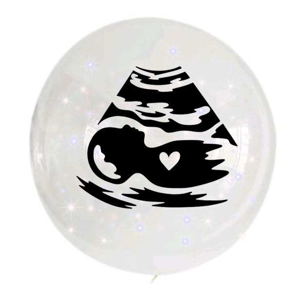 BG - Bobo Balloon - 24inch - Baby Scan