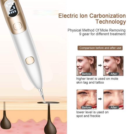 9 Gear LCD Plasma Pen Laser Tattoo Mole Freckle Corns Removal Machine | Buy  Online in South Africa 