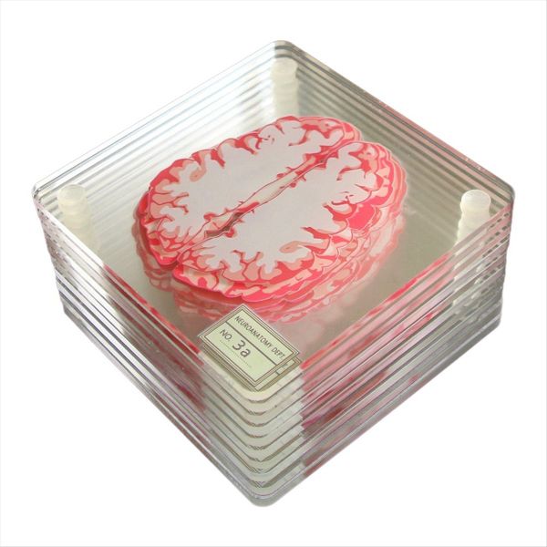 Brain Specimen Coasters Set 3D Organ Brain Artwork Brain Slices Square Acry