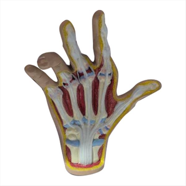 Osteoarthritis Hand Model Model of Hand Pathology Compatible with None
