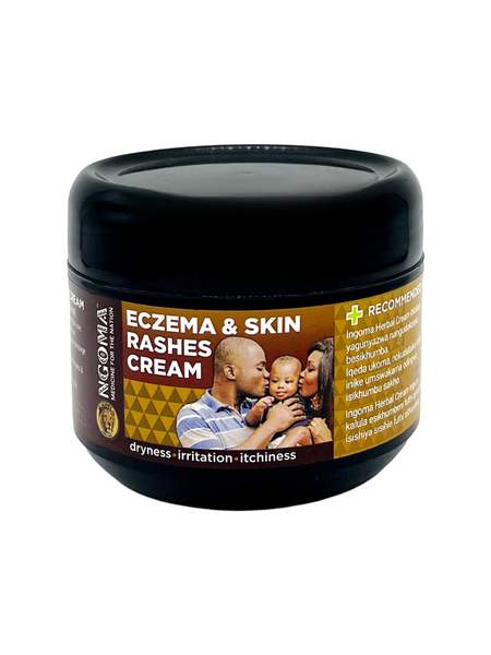 NGOMA - Eczema &amp; Skin Rashes Cream (Dryness, Irritation, Itchiness)