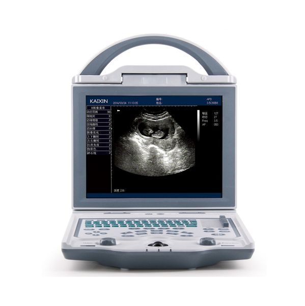 KX5600 Ultrasound Scanner