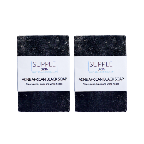 African Acne Black Charcoal Soap