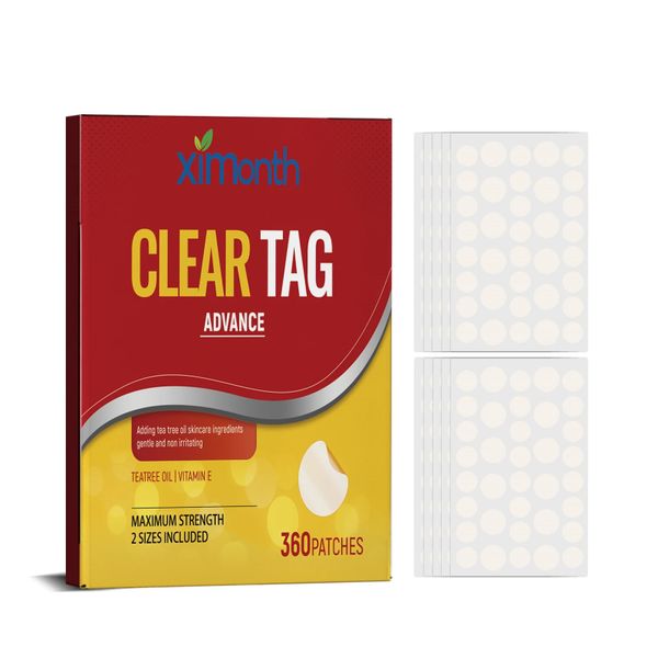 Skin Tags, Mole, Wart And Acne Remover - 360 Patches