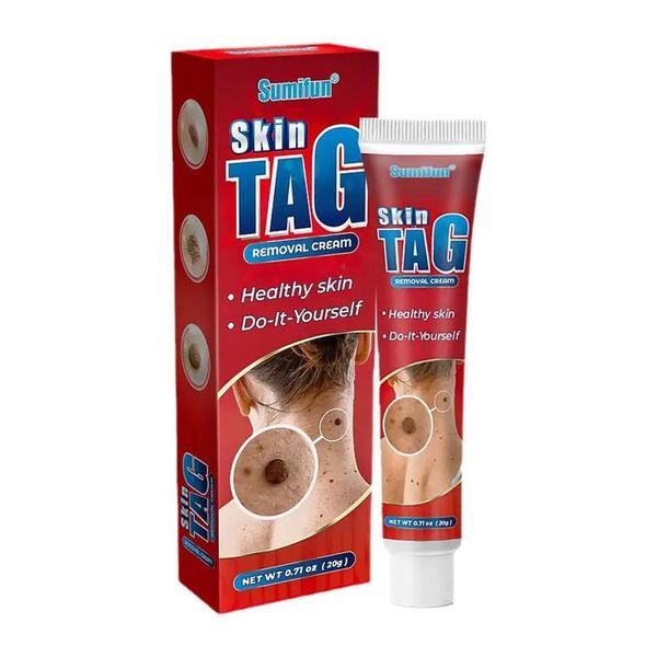 Goshen Skin tag removal cream