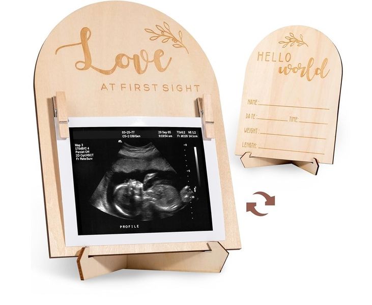 Pregnancy and Baby Birth Annoucements Picture Frame