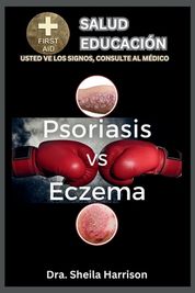 Psoriasis Vs. Eczema: Diferencias, Similitudes, Tipos, S Ntomas, Causas ...