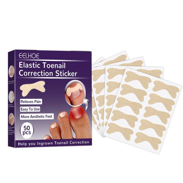 50 Piece Ingrown Toenail Corrector