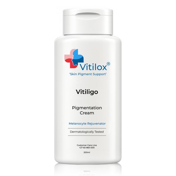 Vitiligo Vitilox Pigmentation Cream