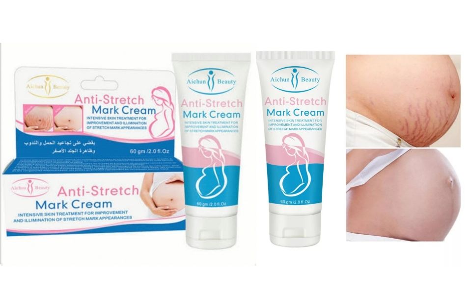 Pack of 2 Aichun Beauty Anti- Stretch Marks Cream ( 80 g each) | Shop ...