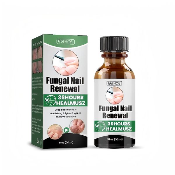 Onychomycosis Repair &amp; Nourishing Liquid - Fingernail &amp; Toenail Care 30ml
