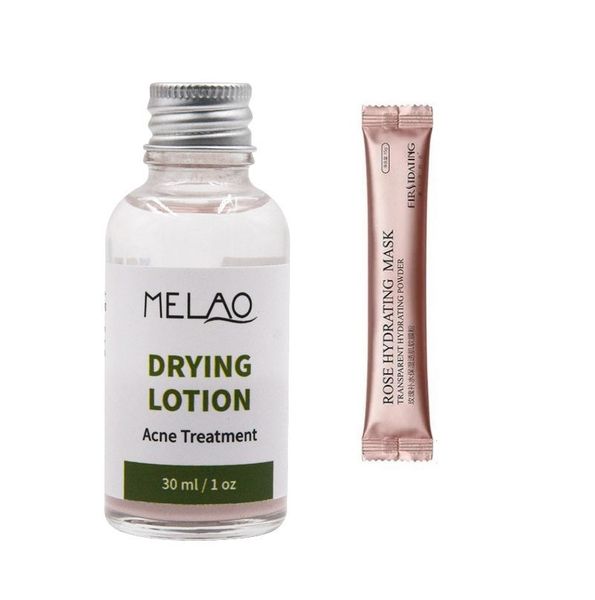 Pimple Acne Drying Calamine Lotion and Jelly Mask