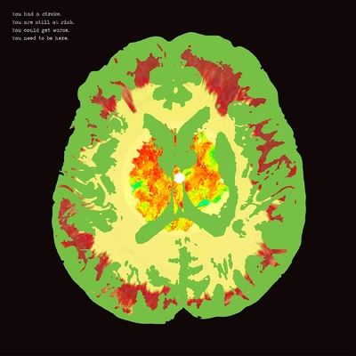 Stroke Manor (RSD 2019) (Vinyl / 12" Album Coloured Vinyl (Limited Edition))