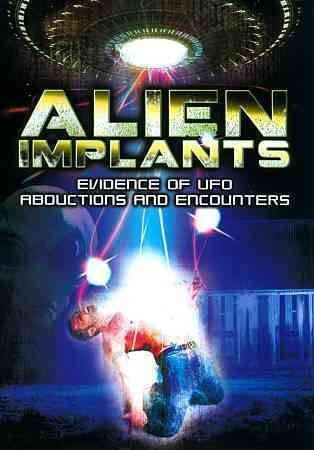 Alien Implants:Evidence of Ufo Abduct - (Region 1 Import DVD)
