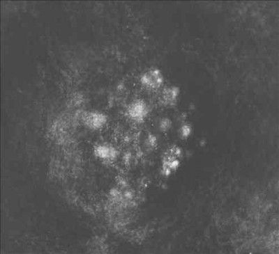 Synecdoche (CD / Album Digipak)