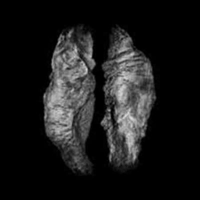 Cause and Effect - (Import Vinyl Record)