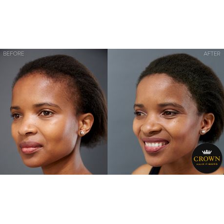 Crown Hair Fibers 25g Conceal Hair Loss Black Buy Online In